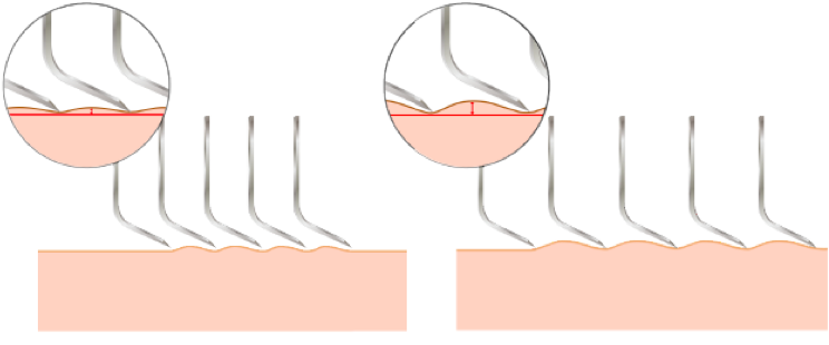 Close set blades diagram for less skin irritation and razor burn